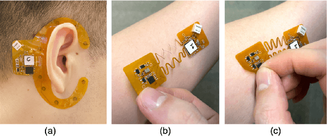 Figure 4 for Multi-Modal Wireless Flexible Gel-Free Sensors with Edge Deep Learning for Detecting and Alerting Freezing of Gait in Parkinson's Patients