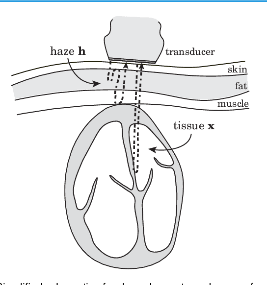 Figure 2 for Dehazing Ultrasound using Diffusion Models