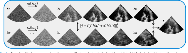 Figure 3 for Dehazing Ultrasound using Diffusion Models