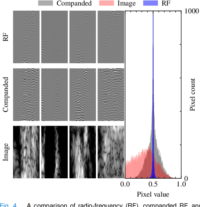 Figure 4 for Dehazing Ultrasound using Diffusion Models