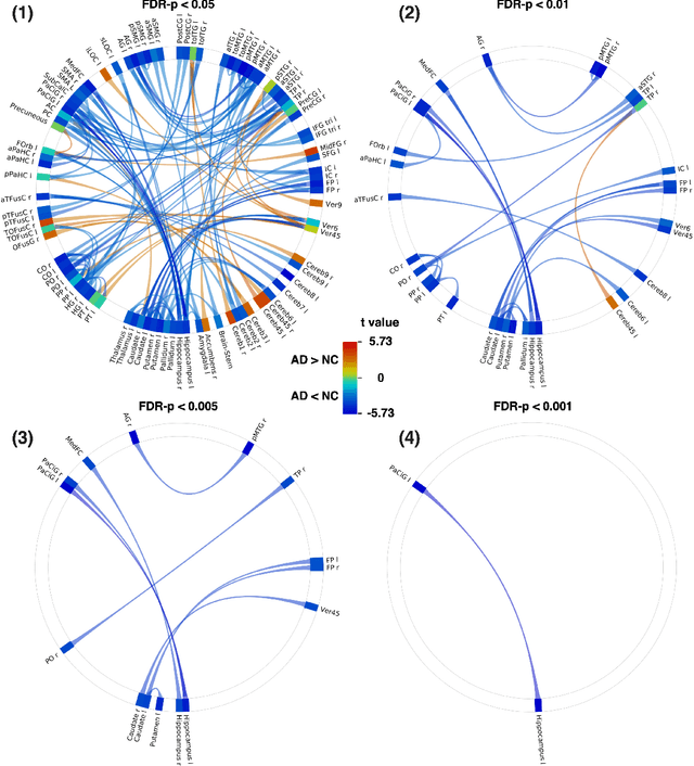 Figure 4 for Abnormal Functional Brain Network Connectivity Associated with Alzheimer's Disease