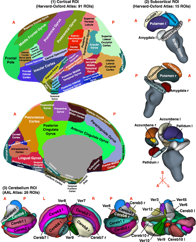Figure 3 for Abnormal Functional Brain Network Connectivity Associated with Alzheimer's Disease