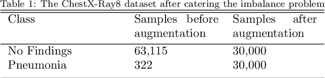 Figure 2 for Pneumonia Detection in Chest X-Ray Images : Handling Class Imbalance