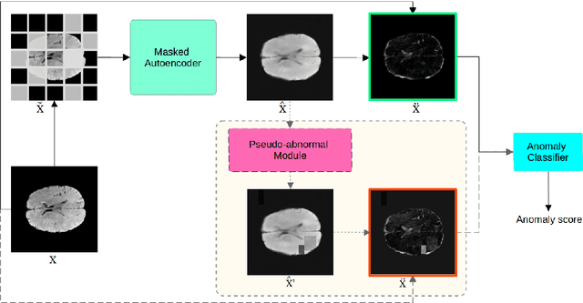 Figure 1 for Masked Autoencoders for Unsupervised Anomaly Detection in Medical Images
