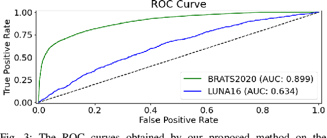 Figure 3 for Masked Autoencoders for Unsupervised Anomaly Detection in Medical Images