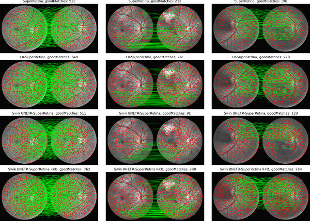 Figure 3 for Reverse Knowledge Distillation: Training a Large Model using a Small One for Retinal Image Matching on Limited Data