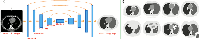 Figure 3 for Improving CT Image Segmentation Accuracy Using StyleGAN Driven Data Augmentation