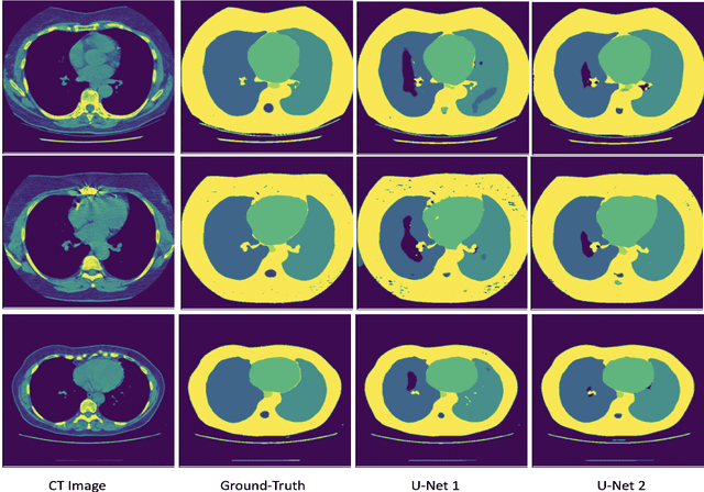 Figure 4 for Improving CT Image Segmentation Accuracy Using StyleGAN Driven Data Augmentation