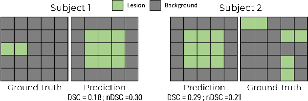 Figure 3 for Tackling Bias in the Dice Similarity Coefficient: Introducing nDSC for White Matter Lesion Segmentation