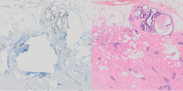 Figure 1 for Editable Stain Transformation Of Histological Images Using Unpaired GANs