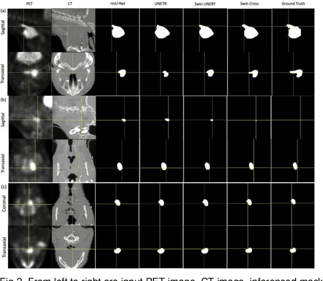 Figure 3 for SwinCross: Cross-modal Swin Transformer for Head-and-Neck Tumor Segmentation in PET/CT Images