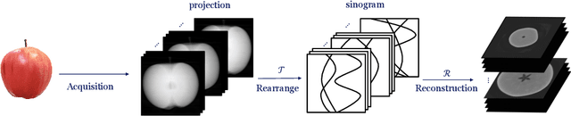 Figure 1 for Multi-stage Deep Learning Artifact Reduction for Computed Tomography