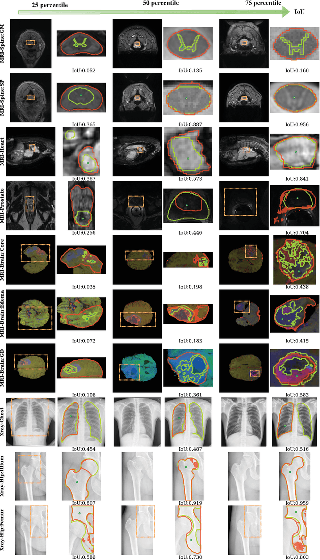 Figure 3 for Segment Anything Model for Medical Image Analysis: an Experimental Study