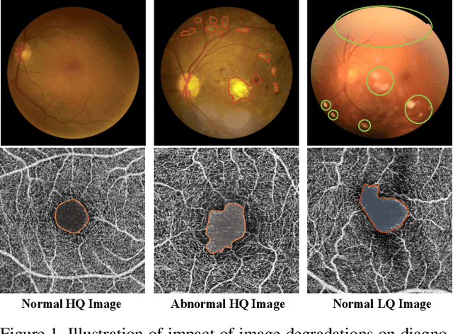 Figure 1 for Image Quality-aware Diagnosis via Meta-knowledge Co-embedding