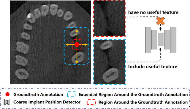 Figure 3 for Two-Stream Regression Network for Dental Implant Position Prediction