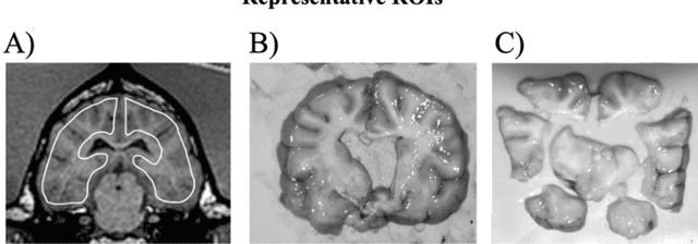 Figure 3 for Quantitative perfusion and water transport time model from multi b-value diffusion magnetic resonance imaging validated against neutron capture microspheres
