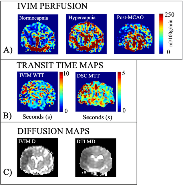 Figure 4 for Quantitative perfusion and water transport time model from multi b-value diffusion magnetic resonance imaging validated against neutron capture microspheres