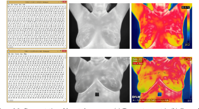 Figure 3 for Breast Cancer Diagnosis Using Machine Learning Techniques