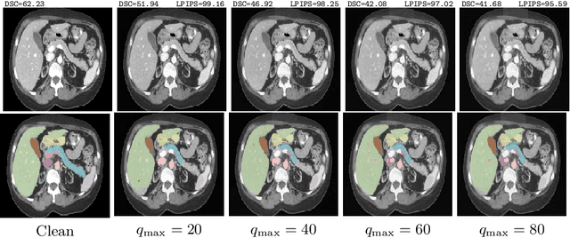 Figure 3 for Frequency Domain Adversarial Training for Robust Volumetric Medical Segmentation