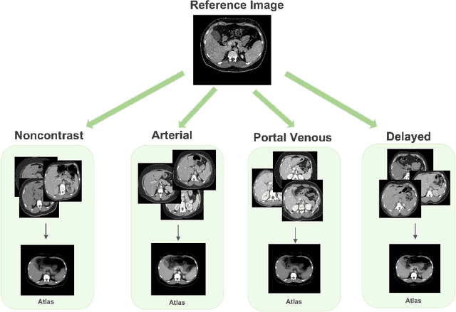 Figure 4 for Multi-Contrast Computed Tomography Atlas of Healthy Pancreas