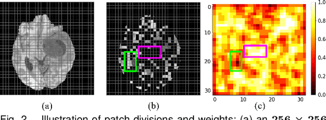 Figure 3 for SLMT-Net: A Self-supervised Learning based Multi-scale Transformer Network for Cross-Modality MR Image Synthesis