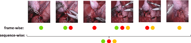 Figure 1 for SAF-IS: a Spatial Annotation Free Framework for Instance Segmentation of Surgical Tools