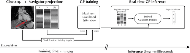 Figure 1 for Real-time myocardial landmark tracking for MRI-guided cardiac radio-ablation using Gaussian Processes