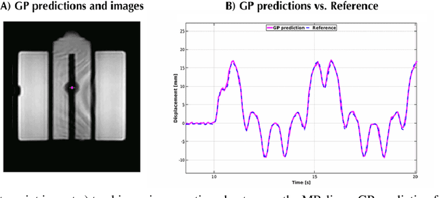 Figure 3 for Real-time myocardial landmark tracking for MRI-guided cardiac radio-ablation using Gaussian Processes