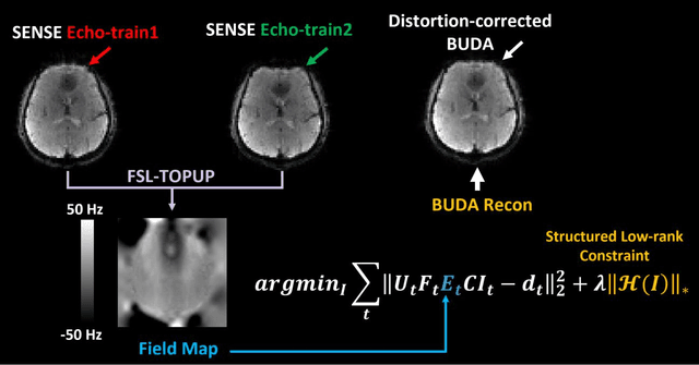 Figure 2 for Three-dimensional echo-shifted EPI with simultaneous blip-up and blip-down acquisitions for correcting geometric distortion