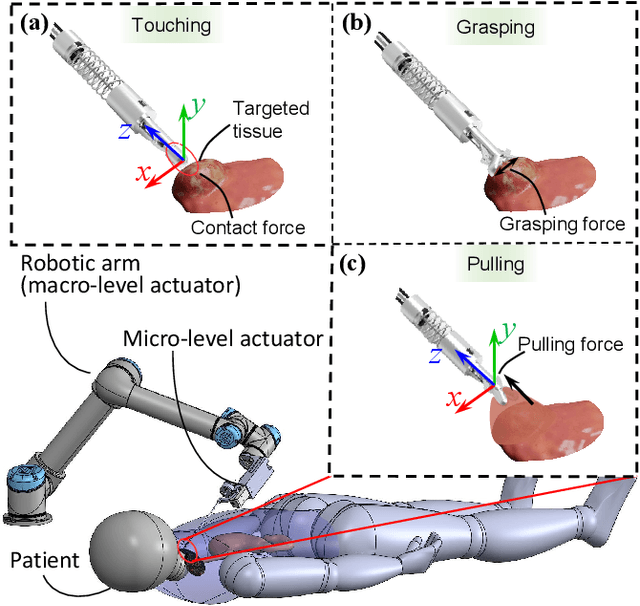 Figure 1 for Haptics-Enabled Forceps with Multi-Modal Force Sensing: Towards Task-Autonomous Robotic Surgery