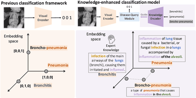 Figure 1 for K-Diag: Knowledge-enhanced Disease Diagnosis in Radiographic Imaging