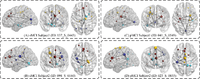Figure 4 for Dynamic Structural Brain Network Construction by Hierarchical Prototype Embedding GCN using T1-MRI