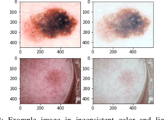 Figure 2 for AttResDU-Net: Medical Image Segmentation Using Attention-based Residual Double U-Net