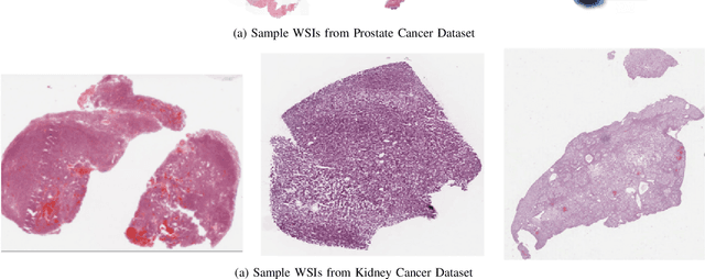 Figure 4 for Explainable and Position-Aware Learning in Digital Pathology