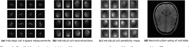 Figure 1 for On Retrospective k-space Subsampling schemes For Deep MRI Reconstruction