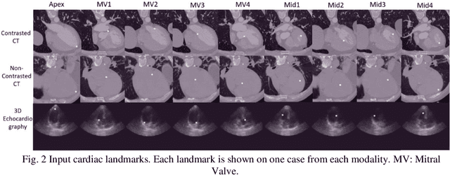 Figure 3 for Deep Conditional Shape Models for 3D cardiac image segmentation