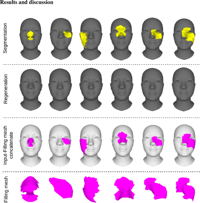Figure 4 for Advancing Wound Filling Extraction on 3D Faces: Auto-Segmentation and Wound Face Regeneration Approach