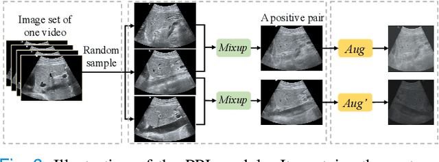 Figure 3 for Generating and Weighting Semantically Consistent Sample Pairs for Ultrasound Contrastive Learning