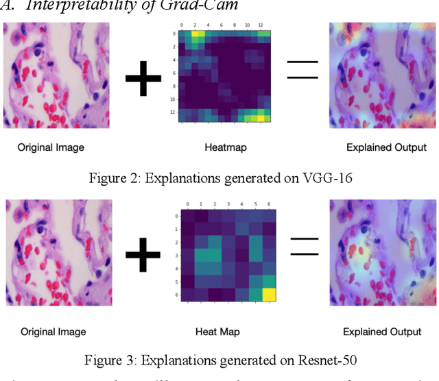 Figure 4 for Analysis of Explainable Artificial Intelligence Methods on Medical Image Classification