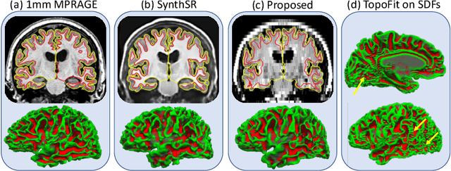 Figure 2 for Cortical analysis of heterogeneous clinical brain MRI scans for large-scale neuroimaging studies