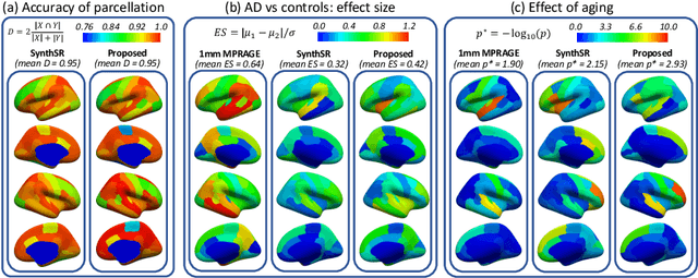 Figure 3 for Cortical analysis of heterogeneous clinical brain MRI scans for large-scale neuroimaging studies