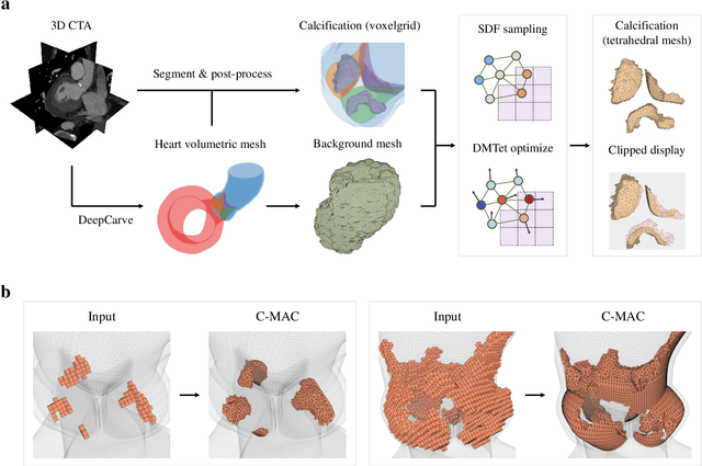 Figure 1 for Robust automated calcification meshing for biomechanical cardiac digital twins