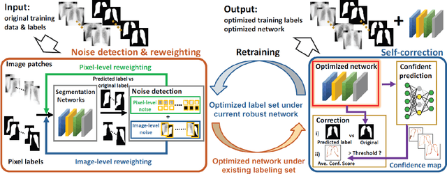 Figure 3 for Push the Boundary of SAM: A Pseudo-label Correction Framework for Medical Segmentation