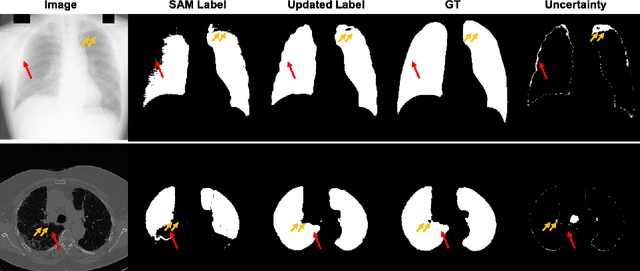 Figure 4 for Push the Boundary of SAM: A Pseudo-label Correction Framework for Medical Segmentation