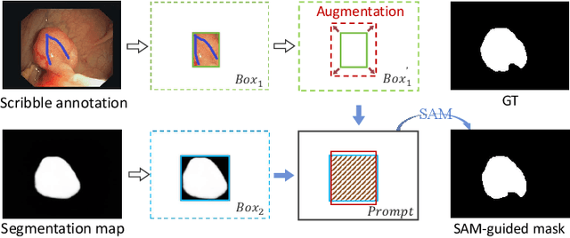 Figure 4 for Segment Anything Model-guided Collaborative Learning Network for Scribble-supervised Polyp Segmentation