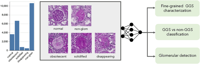 Figure 1 for Holistic Fine-grained GGS Characterization: From Detection to Unbalanced Classification