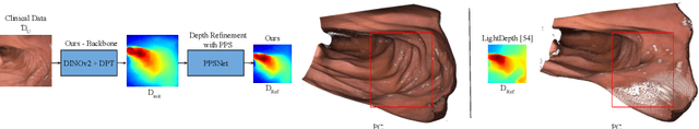 Figure 1 for Leveraging Near-Field Lighting for Monocular Depth Estimation from Endoscopy Videos