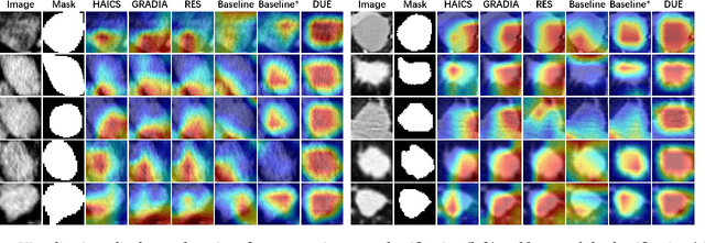 Figure 4 for DUE: Dynamic Uncertainty-Aware Explanation Supervision via 3D Imputation