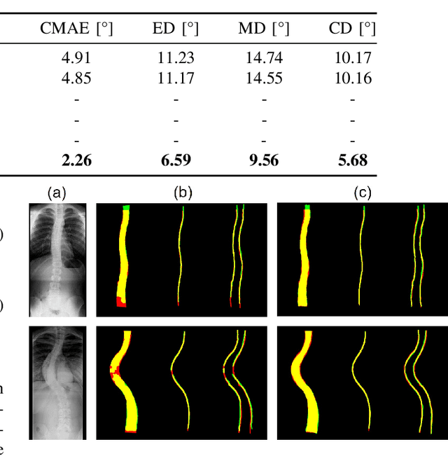 Figure 3 for MMA-Net: Multiple Morphology-Aware Network for Automated Cobb Angle Measurement