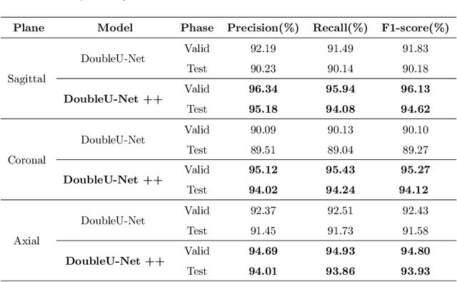 Figure 2 for DoubleU-Net++: Architecture with Exploit Multiscale Features for Vertebrae Segmentation